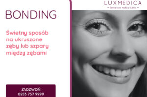 Bonding zębów